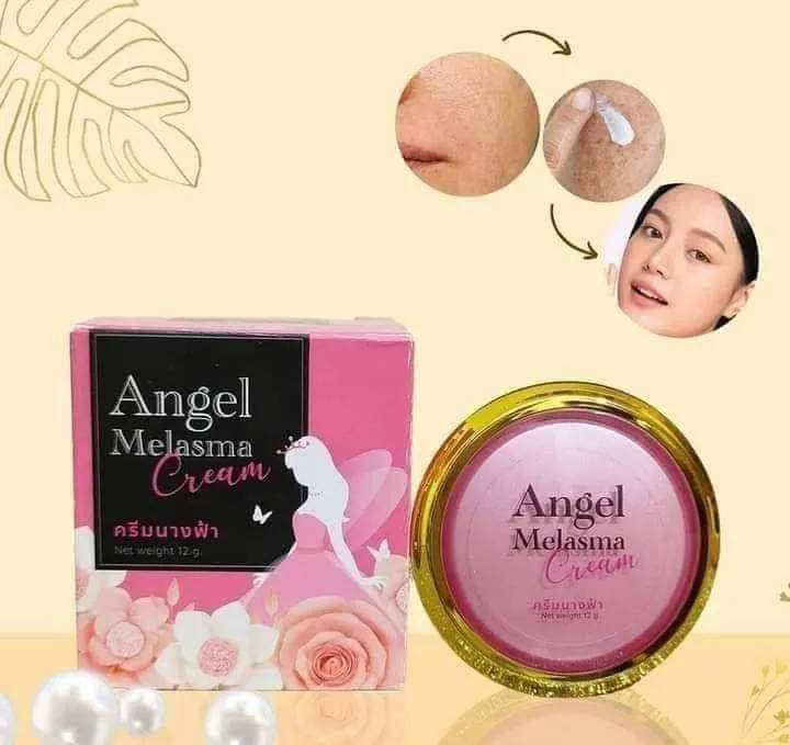 Angel melasma cream